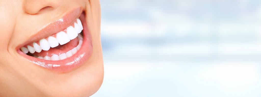 plano-dental-cobre-gengivoplastia