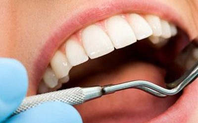 A importância de contratar plano dental antes do implante 0 (0)