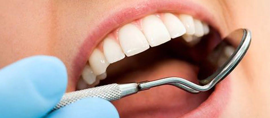 A importância de contratar plano dental antes do implante 0 (0)