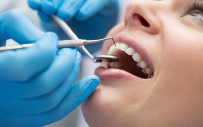 W. Dental Próteses e Amil Dental E170: qual é o melhor plano odontológico? 5 (1)